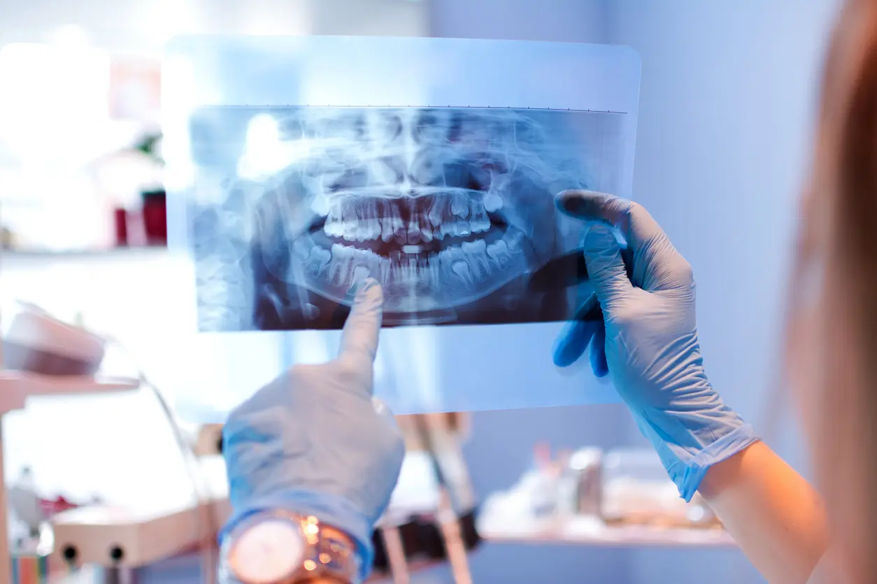 Un dentiste qui regarde une radio des dents
